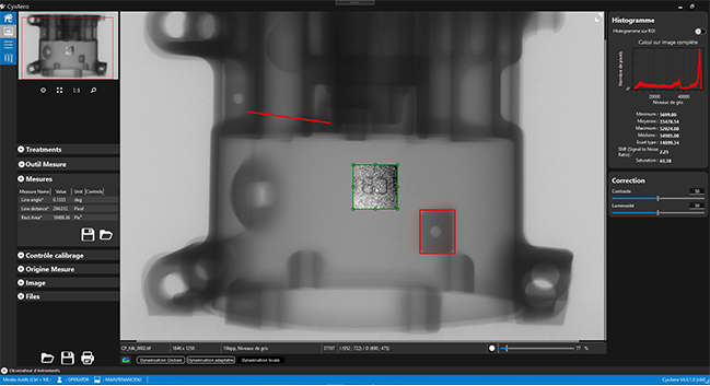 CyXray : 2D X-ray software